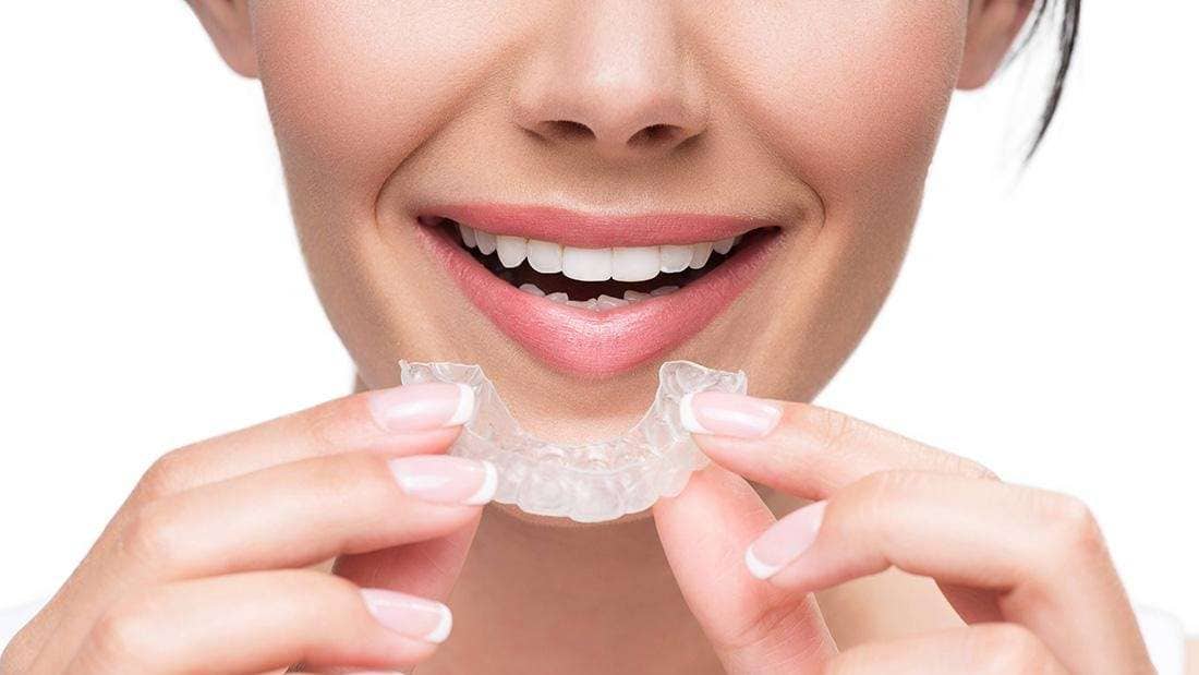 Paciente valorando brackets en Carabanchel con Clínica Doctores Romero