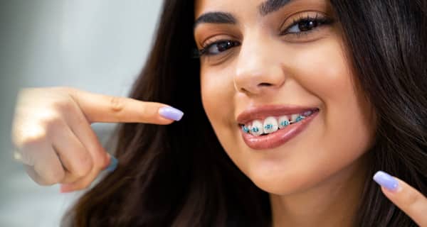 Brackets metálicos para valorar ortodoncia cerca de Arganzuela