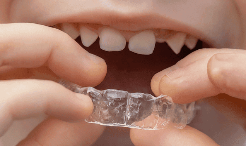 Brackets en el centro de Madrid — Doctores Romero