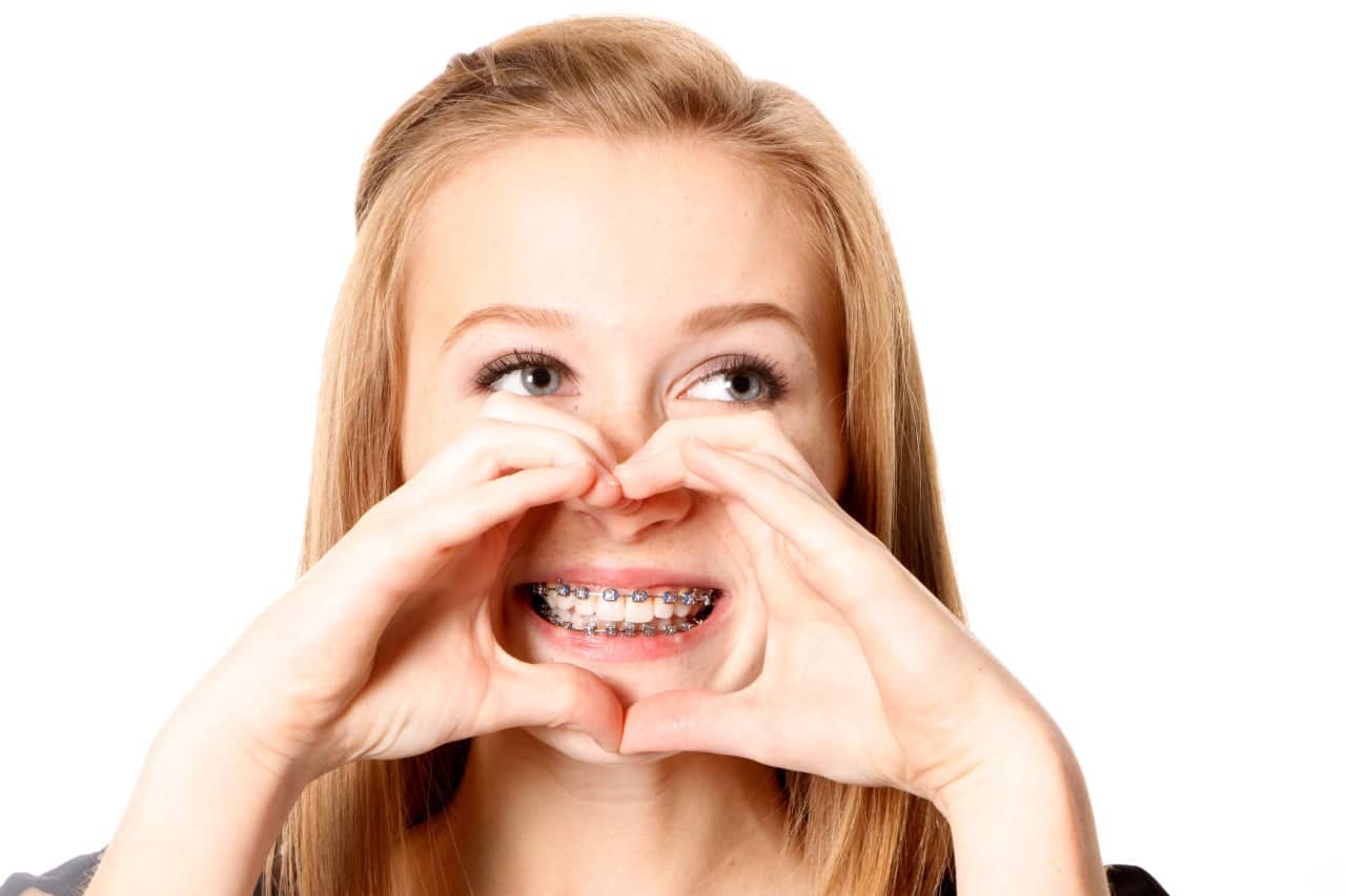 Sonrisa con brackets estéticos para explicar higiene y cepillado