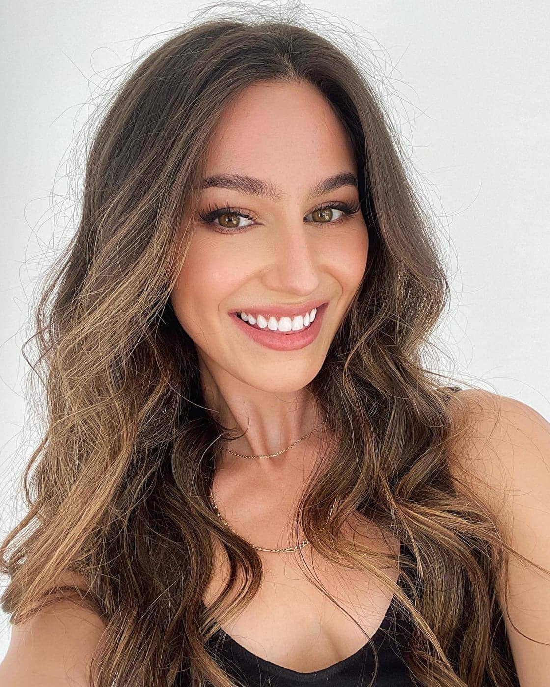 Sonrisa natural después de una transformación dental planificada