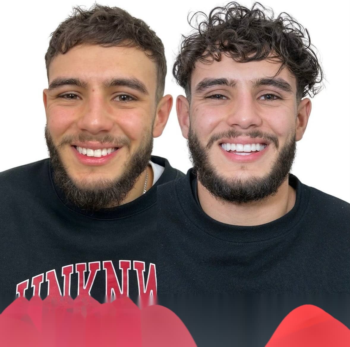 Paciente con diseño de sonrisa en consulta dental