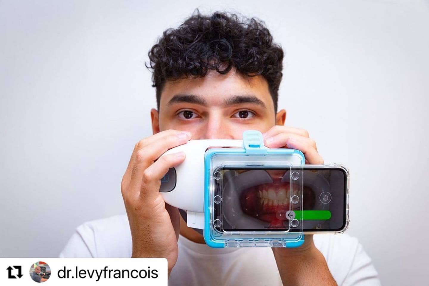 FAQ implantes dentales — Clínica Doctores Romero Madrid