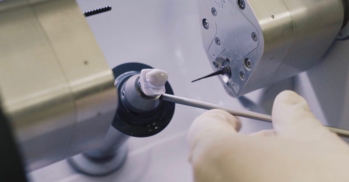 Corona dental digital para completar un plan de implantes
