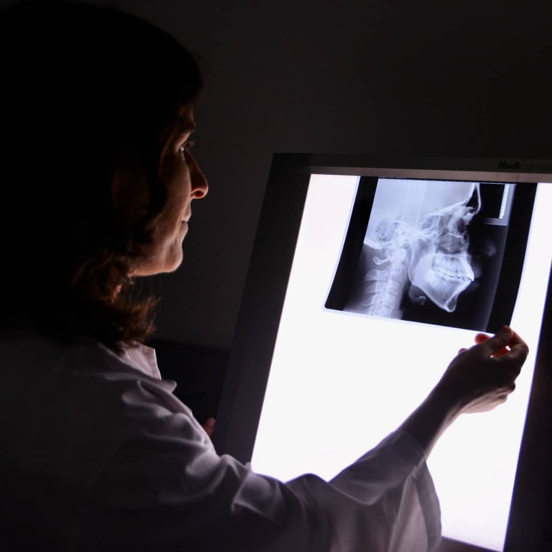 Planificación de implantes dentales para pacientes de Fuencarral El Pardo