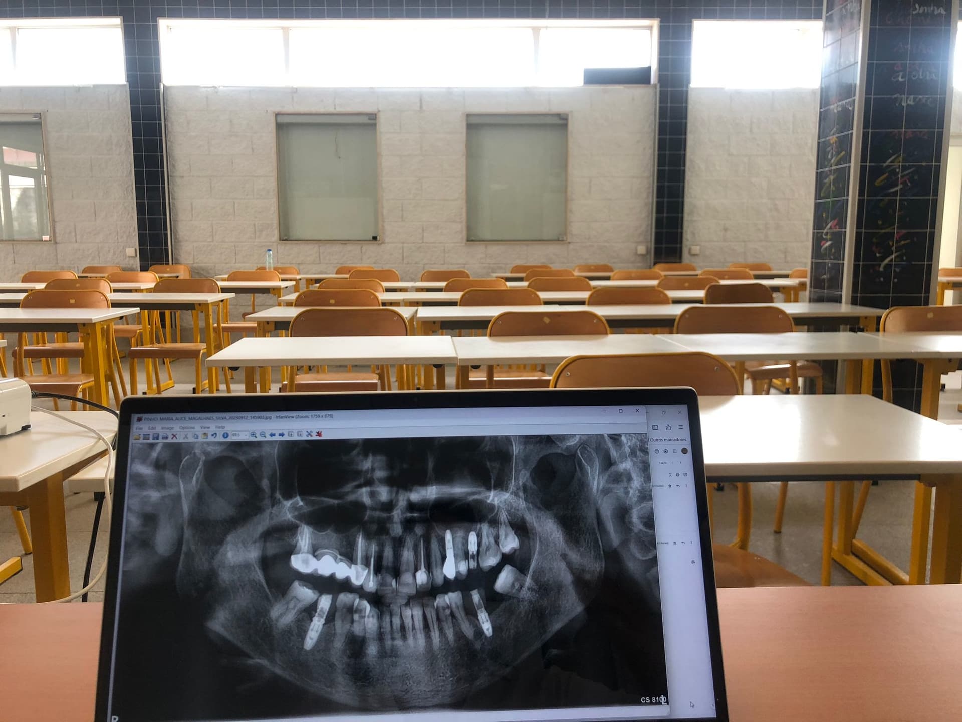 Planificación digital de implantes dentales cerca de Hortaleza