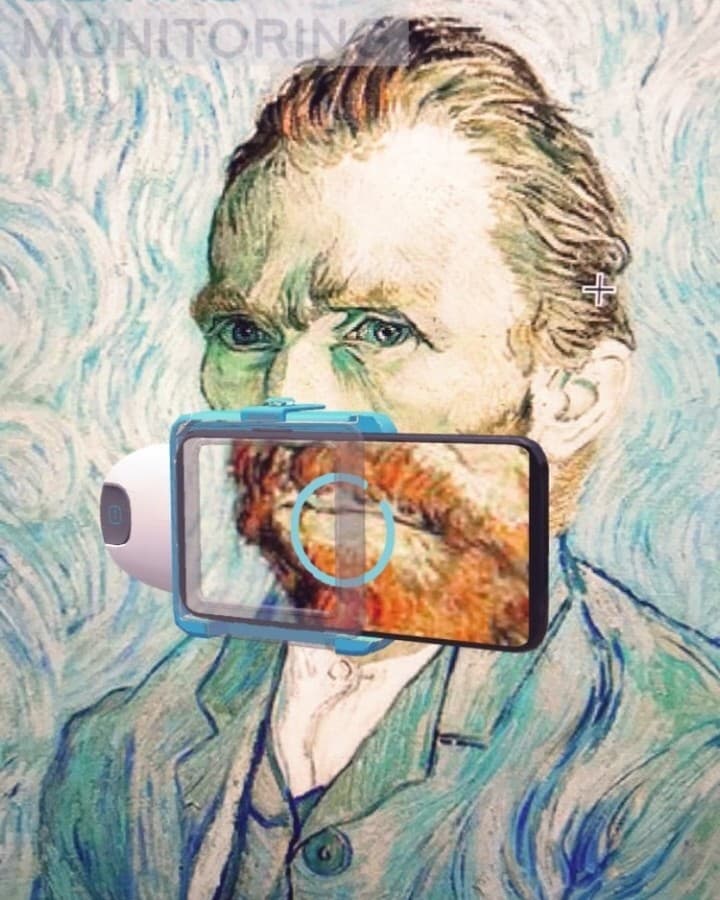 Implantes Dentales Precio Madrid 2026 — Dr. Carlos, 5.000+ Implantes