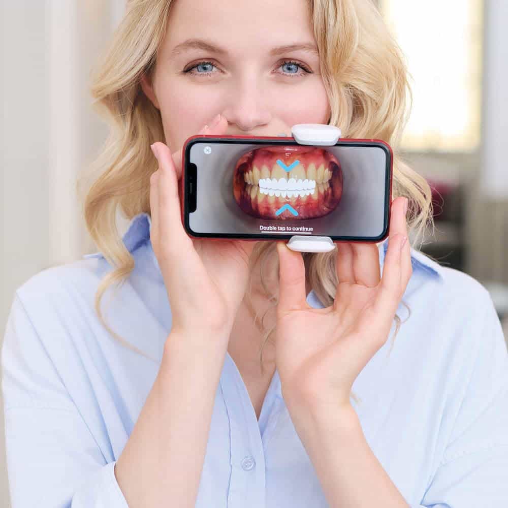 Mejor o buen ortodoncista Invisalign en Madrid: cómo decidir