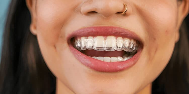 Ortodoncia invisible precio Madrid 2026 · Invisalign y alineadores
