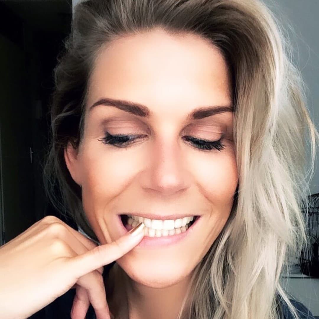 Ortodoncia para Adultos en Madrid — Dr. Juan, Diamond Plus