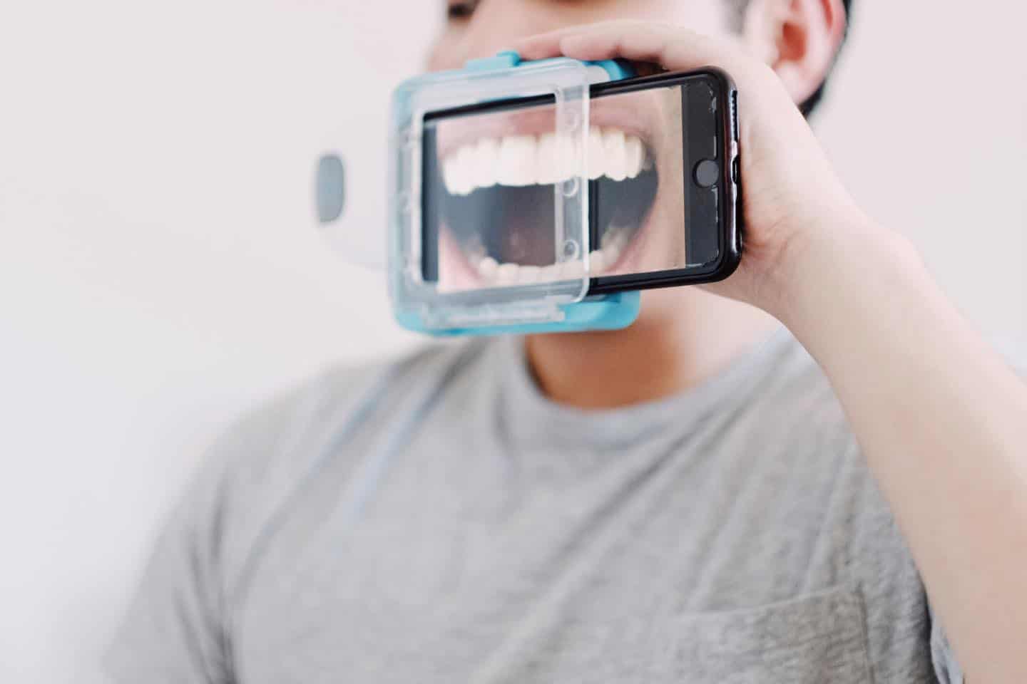 Escaneo digital para seguimiento de tratamiento Invisalign