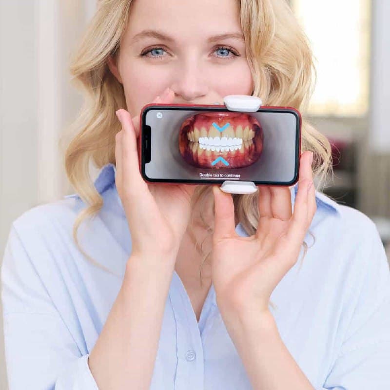 Dental Monitoring en Clínica Doctores Romero Madrid