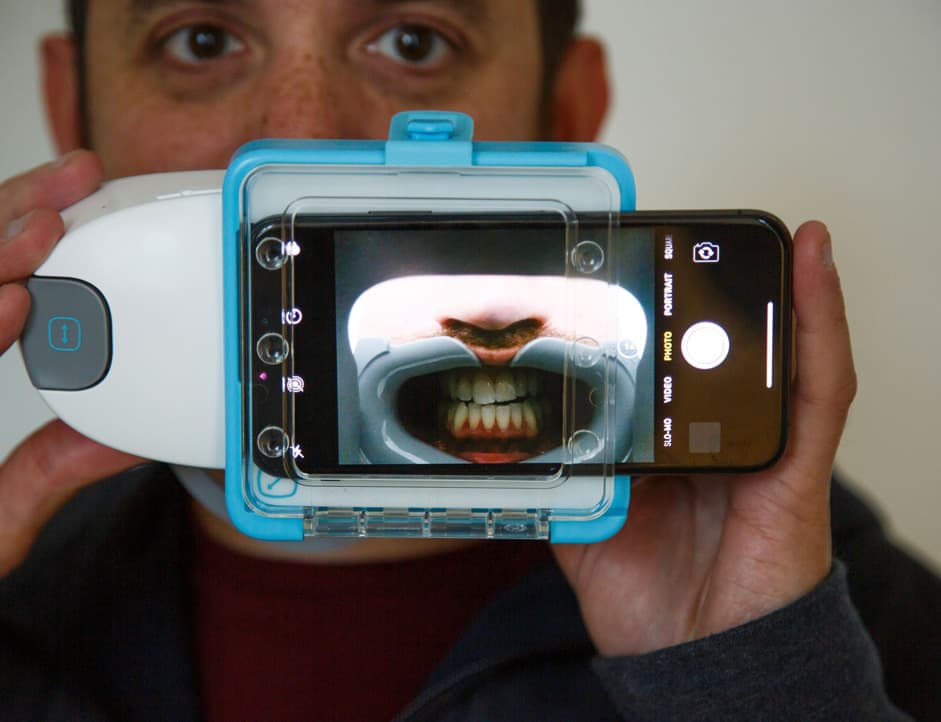 Escaneo de Dental Monitoring con móvil y ScanBox