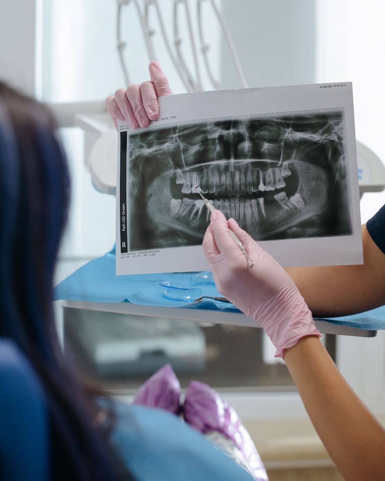 Radiografía dental revisada para decidir si conservar un diente o planificar un implante