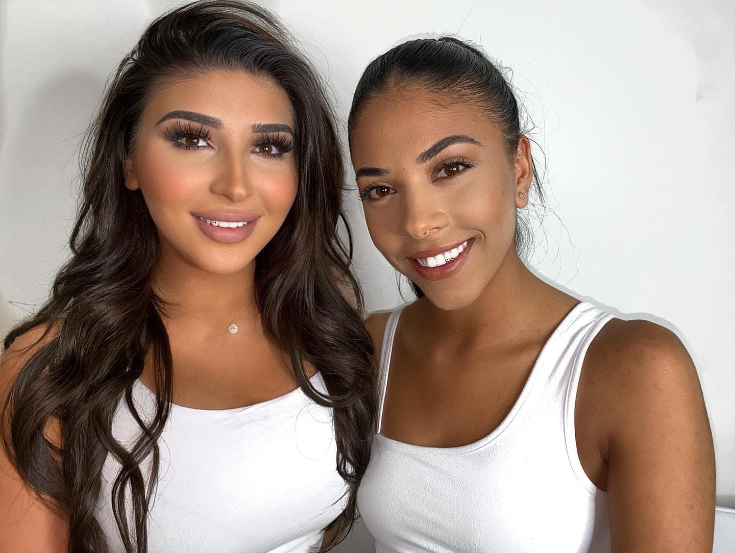 Sonrisa luminosa y natural tras valorar blanqueamiento dental profesional