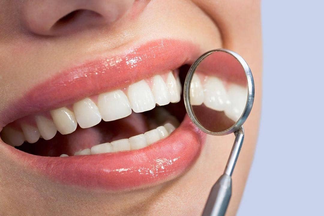 Revisión clínica de una restauración dental natural