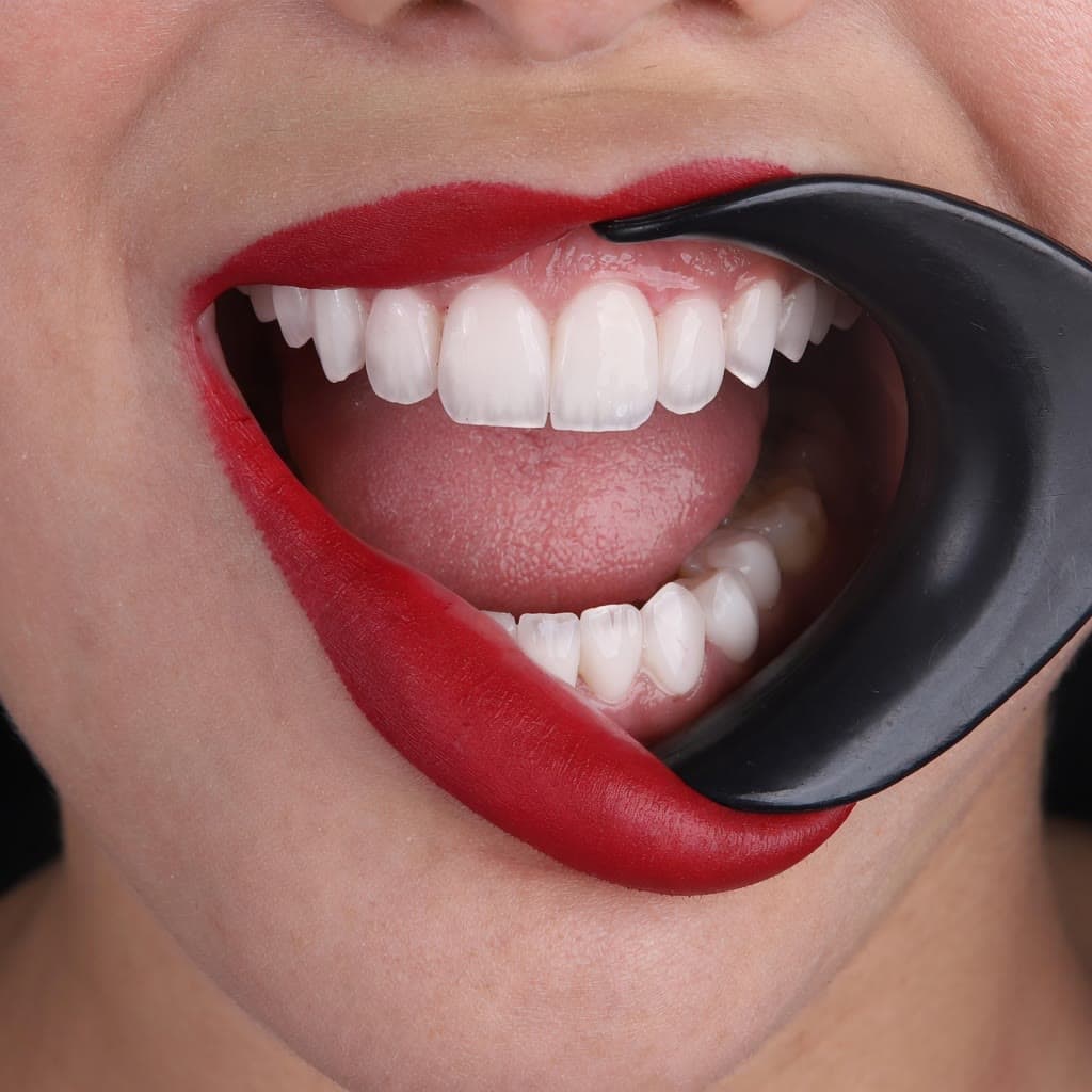 Fotografía dental para planificar estética y diseño de sonrisa