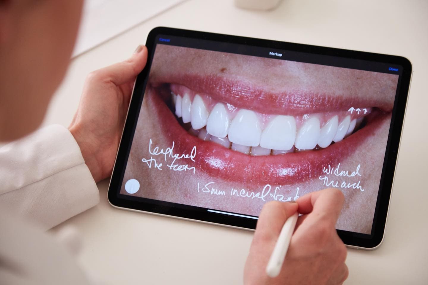 Diseño de sonrisa en Clínica Doctores Romero Madrid