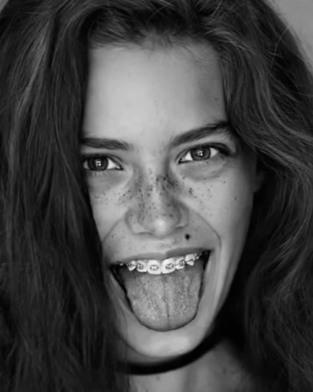 Paciente con brackets estéticos sonriendo durante tratamiento de ortodoncia