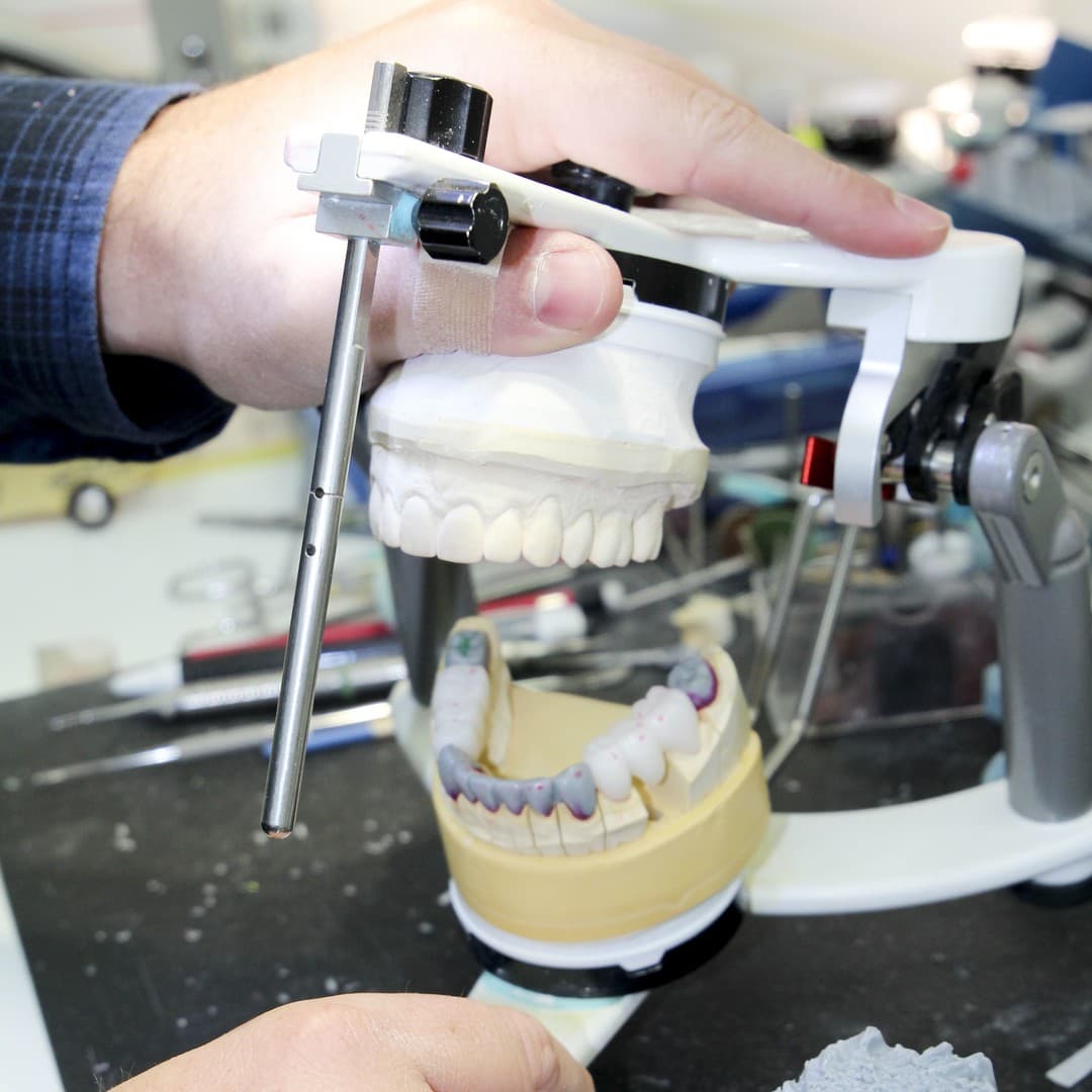 Articulador dental para revisar mordida y carga en bruxismo