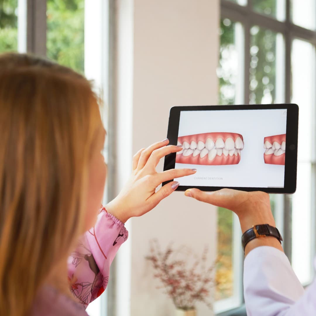 Planificación digital para valorar ortodoncia invisible en Madrid