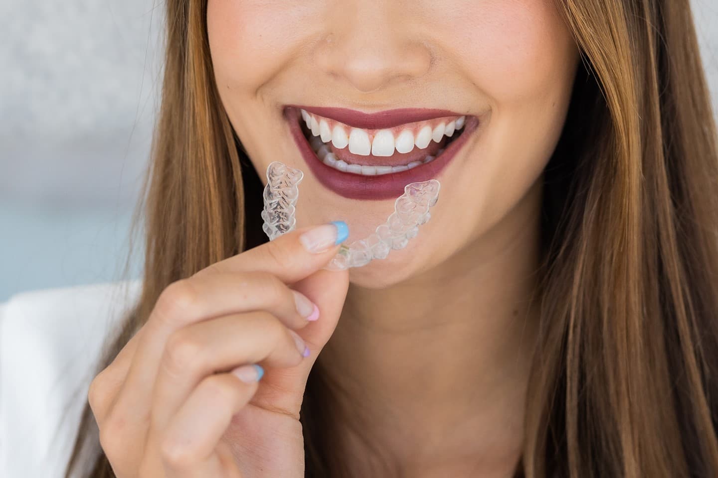 Invisalign en Clínica Doctores Romero Madrid