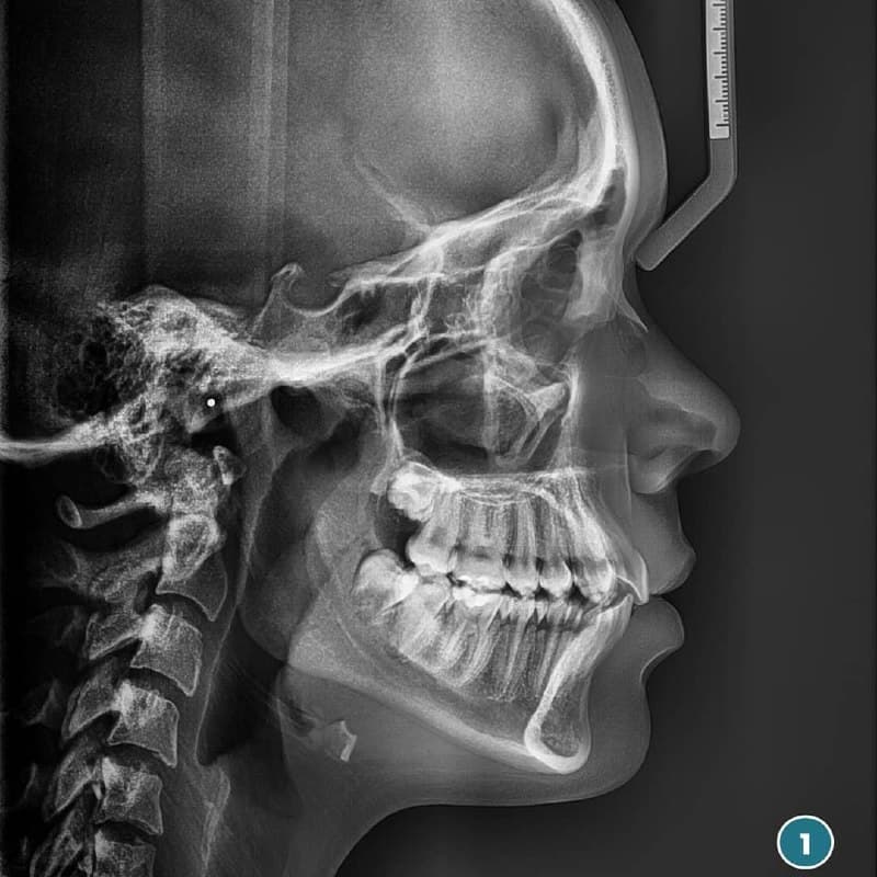 Radiología dental en Clínica Doctores Romero Madrid
