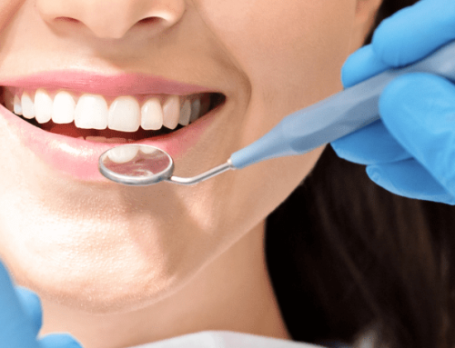 Limpieza Dental Profesional — Precio, Proceso y Beneficios