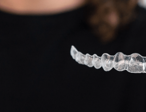 ¿Duele el Invisalign? Lo que Nadie te Cuenta