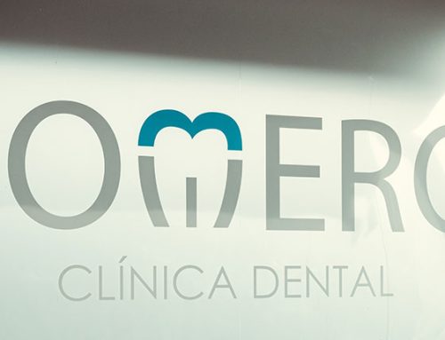 Implantes Dentales cerca de Chamartín Madrid — Clínica Doctores Romero
