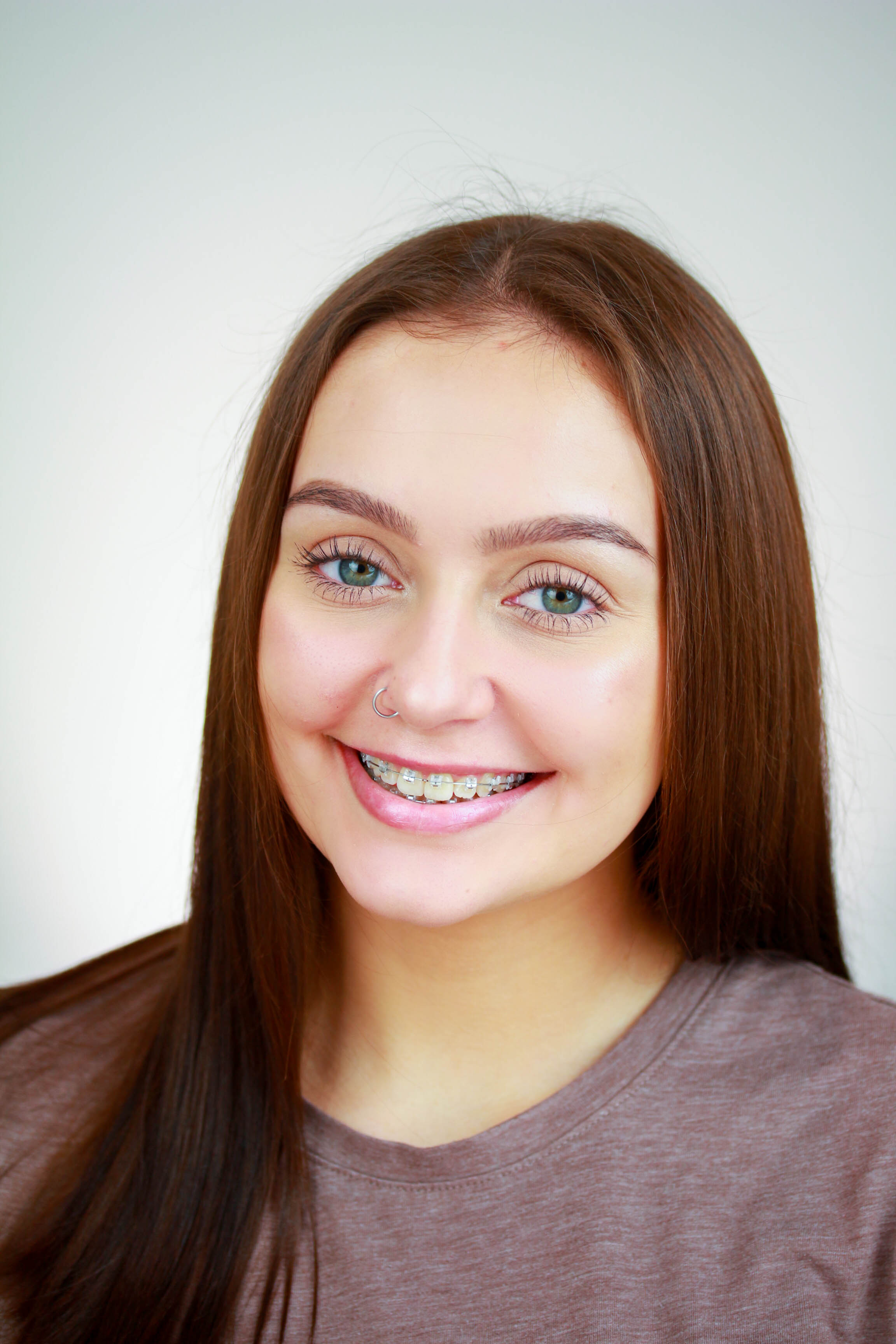 Revisión Dental Madrid